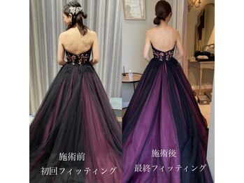 コルミチョン サロン(骨美整 salon)/ブライダル施術　Before・After