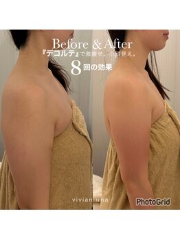 ヴィヴィアン 太田川店(Vivian)/気になる二の腕！背中まわり！