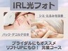 ≪フェイシャル≫ IPL光フォト＆フェイシャルエステ完璧コース ◆9900円