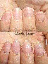 マリーロール 淀屋橋本店(Marie Laure)/自爪育成/深爪矯正/ネイルケア