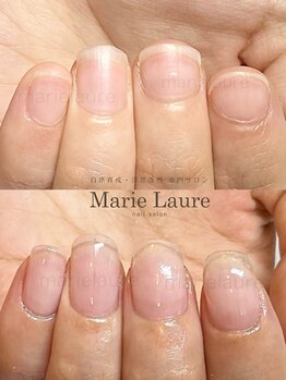 マリーロール 淀屋橋本店(Marie Laure)/自爪育成/深爪矯正/ネイルケア