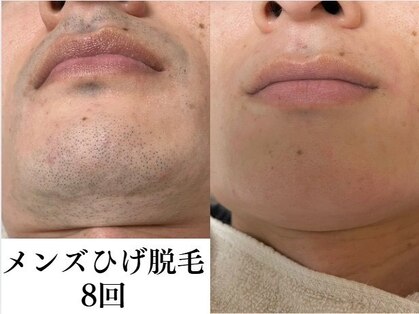 エミエット(Emiette)の写真