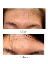 サロン リノ(salon rino)/