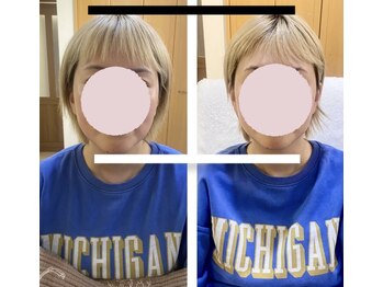 ララ(LARA.)/小顔矯正