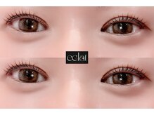 エクラ(eclat)/リフトカール