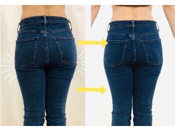 オリエンタル ルボワール(oriental Revoir)/下半身骨盤矯正カッピング