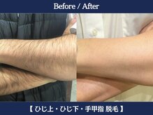 ランドマーク 中崎町(LANDMARK.)/《 腕 》