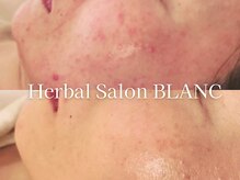 ブラン 名古屋高岳(BLANC)