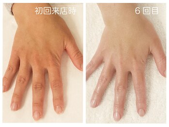 キレイテ 上野店/40代/6回目【ハンドケア稲荷町】