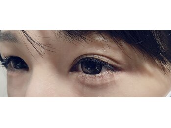 フリルアイビューティ 豊中店(Frill Eye Beauty)/