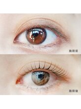 レディアリス(L'Alice)/アップフォースリフト