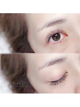 リヨン(LYON+831)/