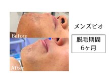 メンズビオ 神戸三宮店/