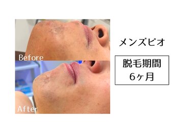 メンズビオ 神戸三宮店/