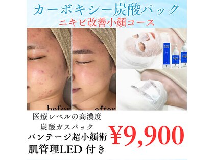 キレナル(KIRENAL)の写真