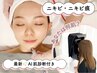 【ニキビケア】AI肌診断+毛穴洗浄+凸凹肌用ピーリング+潤導入+赤み鎮静パック