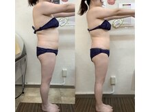 エステ ド モモコ/PRセル(部分ケア)