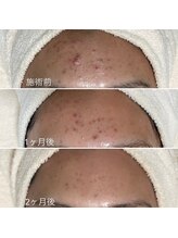 シェノン 赤坂大濠店/