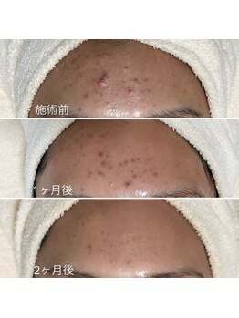 シェノン 赤坂大濠店/