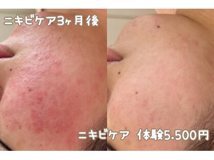 れふぇるん 足利店の写真