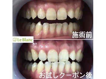 ルブラン 奈良店(Le Blanc)/試せば分かる!!