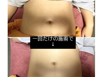 イールーム(eroom)/美body総体(ウエスト特化痩身)