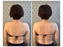 ココア(CoCoa)/肩甲骨洗浄