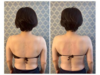 ココア(CoCoa)/肩甲骨洗浄