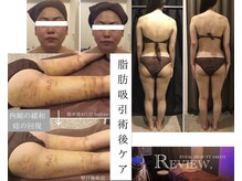 トータルビューティーサロン レビュー(REVIEW)