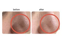 マーレ(Mare)/メンズのご来店も大歓迎！