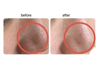 マーレ(Mare)/メンズのご来店も大歓迎！