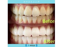 アーヒル(A”-HILU)の雰囲気（ホワイトニング/石川ホワイトニング/金沢/野々市/マウスピース）