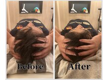 整体ラルース 中目黒(LALUZ)/30代 男性 小顔ヘッドスパ 変化