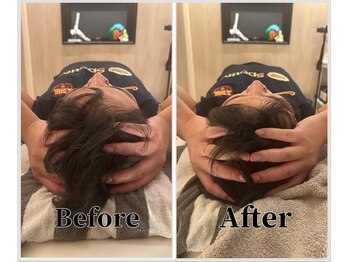 整体ラルース 中目黒(LALUZ)/30代 男性 小顔ヘッドスパ 変化