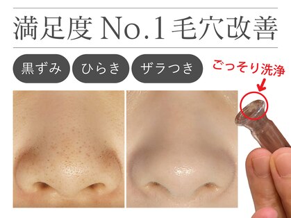 オーシャンブルー 福岡店(OCEAN BLUE フェイシャル&ボディ)の写真