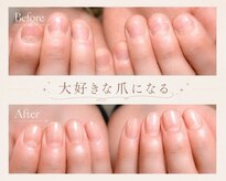 ケイト(Kate)