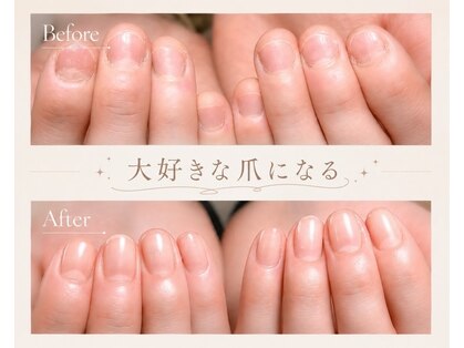 ケイト(Kate)の写真