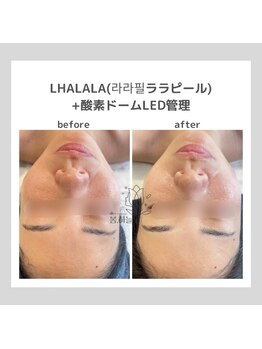 ポムハヌル(pom.haneul)/韓国肌管理室