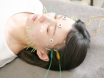 ラフテル鍼灸整骨院/美容鍼はパルスも追加可能♪