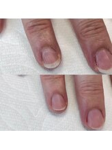 プラス(Plus)/究極のネイルケア