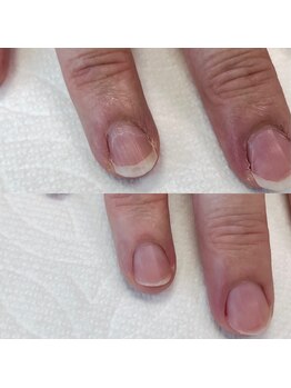 究極のネイルケア