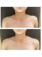 ニコサロン(nico salon)/ガチガチ首肩スッキリ全身リンパ