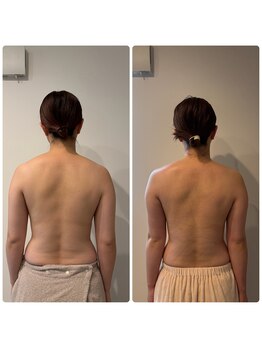 アロラヴィ(AroRavi)/ブライダルエステ