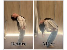 整体ラルース 中目黒(LALUZ)/20代　女性　腰痛、猫背改善