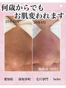 ベベ(bebe)/何歳からでも変われる