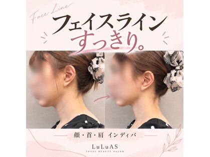 ルルアス(LuLuAS)の写真