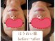 アップフェリス(Uppfeliz)の写真/【新感覚!オーラルエステ】お口の内外から筋肉を緩め、ほうれい線・たるみ改善の贅沢ケア◎