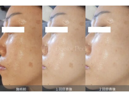 ミラ 中央林間(mira)の写真