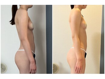 モア(moa)/症例写真