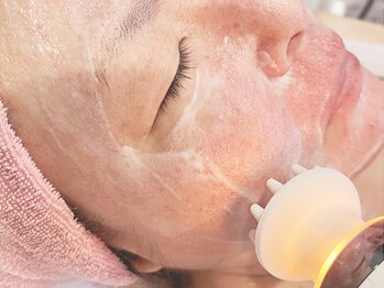 メリッサの写真/ホウレイ線、たるみアプローチ！その日の効果をその場で確認できる。エイジングケアはメリッサで！